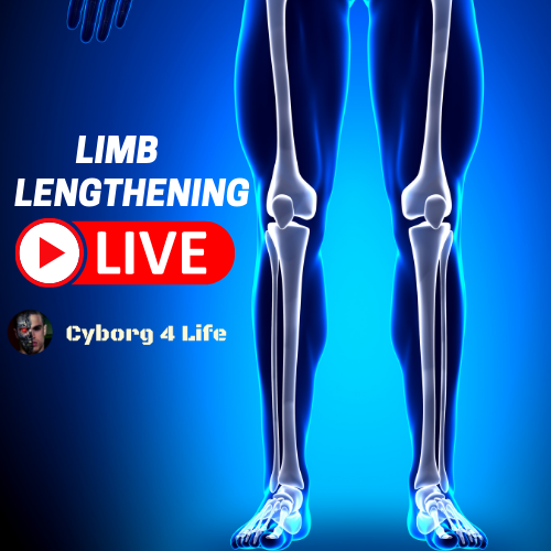 limb lengthening live